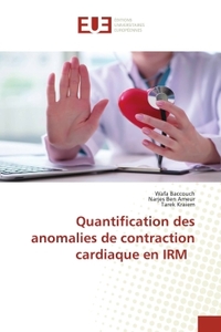 Image de Quantification des anomalies de contraction cardiaque en IRM