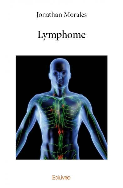 Image de Lymphome