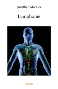 Image de Lymphome