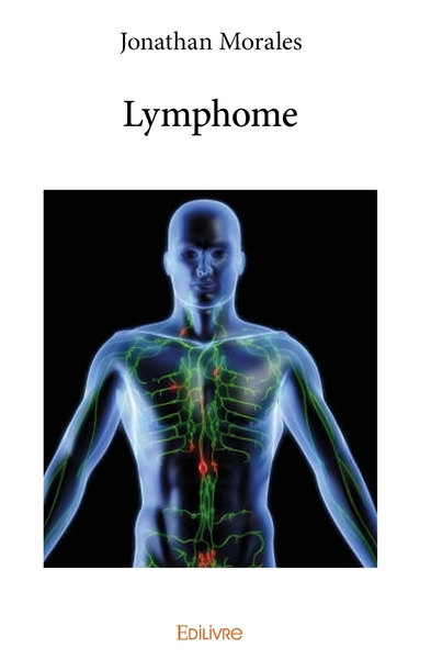 Picture of Lymphome