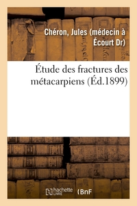 Image de Étude des fractures des métacarpiens