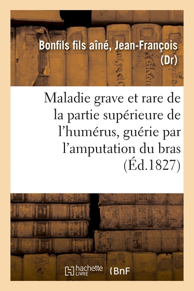 Image de Description succincte d'une maladie grave et rare de la partie supérieure de l'humérus