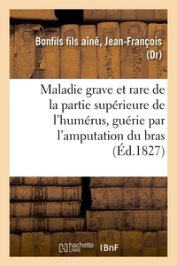 Image de Description succincte d'une maladie grave et rare de la partie supérieure de l'humérus