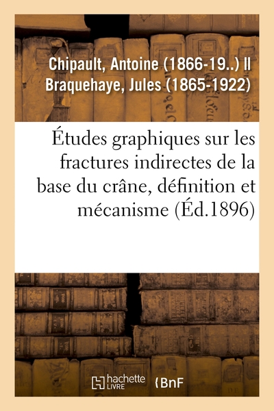 Image de Études graphiques sur les fractures indirectes de la base du crâne, définition et mécanisme