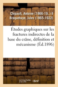 Image de Études graphiques sur les fractures indirectes de la base du crâne, définition et mécanisme