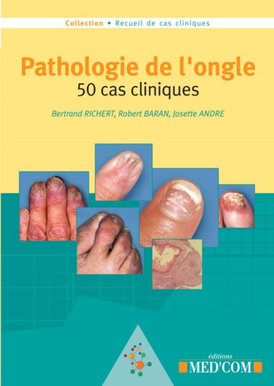 Image de PATHOLOGIE DE L ONGLE  50 CAS CLINIQUES