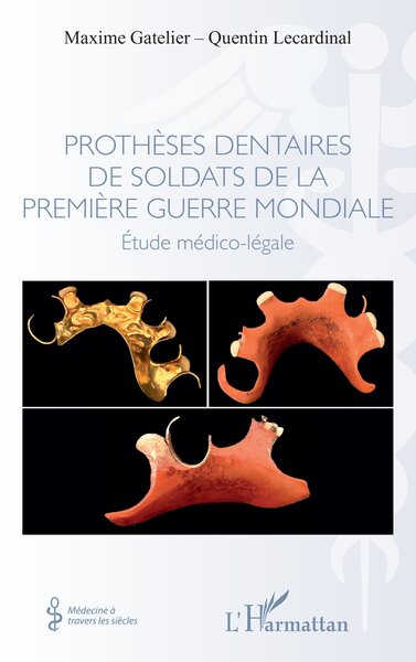 Picture of Prothèses dentaires de soldats de la Première Guerre Mondiale