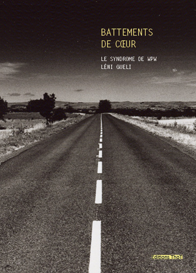 Image de Battements de cœur, le syndrome de WPW