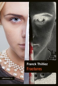 Picture of Fractures