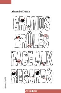 Picture of Grands brûlés face aux regards