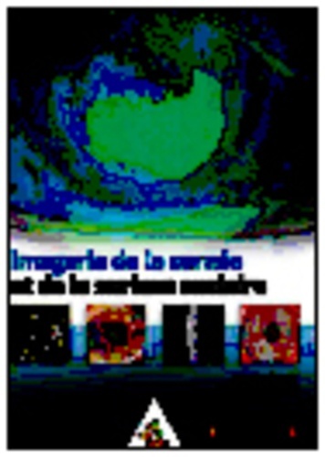 Picture of IMAGERIE DE LA CORNEE ET DE LA SURFACE OCULAIRE