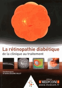 Picture of LA RETINOPATHIE DIABETIQUE :DE LA CLINIQUE AUTRAITEMENT