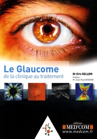 Picture of LE GLAUCOME