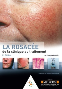 Picture of LA ROSACEE. DE LA CLINIQUE AU TRAITEMENT