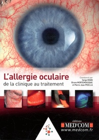 Picture of L ALLERGIE OCULAIRE DE LA CLINIQUE AU TRAITEMENT