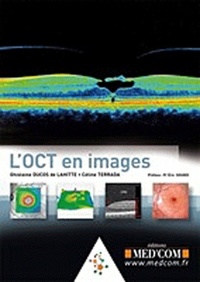 Image de L'OCT EN IMAGES