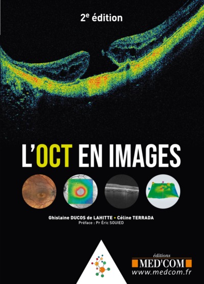 Image de L oct en images. 2° ed