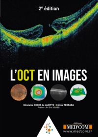 Image de L oct en images. 2° ed