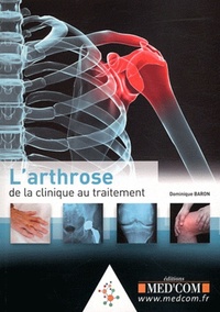 Picture of L'ARTHROSE : DE LA CLINIQUE AU TRAITEMENT