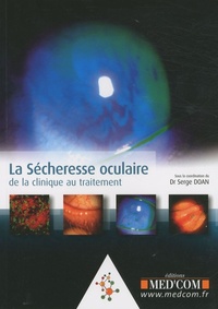 Image de LA SECHERESSE OCCULAIRE