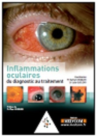 Picture of L'INFLAMMATION OCULAIRE -DE LA CLINIQUE AU TRAITEMENT