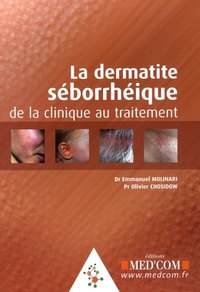 Picture of LA DERMITE SEBORRHEIQUE DE LA CLINIQUE AU TRAITEMENT