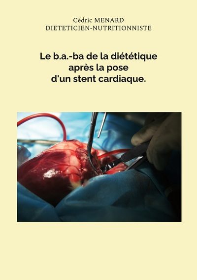 Image de Le b.a.-ba de la diététique après la pose d'un stent cardiaque.