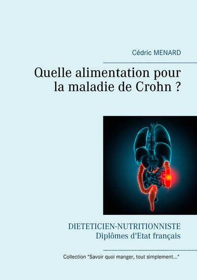Image de Quelle alimentation pour la maladie de Crohn ?