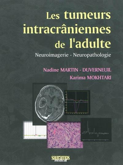 Picture of LES TUMEURS INTRACRANIENNES DE L ADULTE
