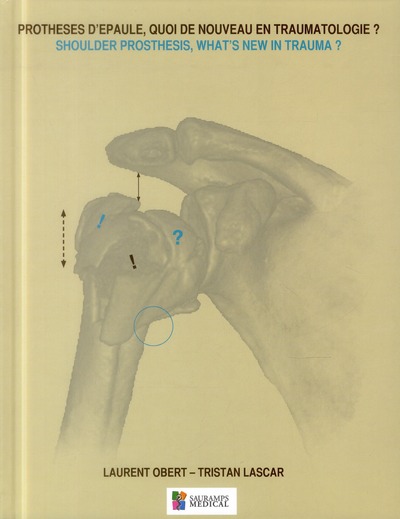 Picture of PROTHESES D'EPAULE, QUOI DE NOUVEAU EN TRAUMATOLOGIE ? SHOULDER PROSTHESIS, WHAT
