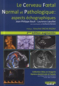 Image de LE CERVEAU FOETAL NORMAL ET PATHOLOGIQUE : ASPECTS ECHOGRAPHIQUES