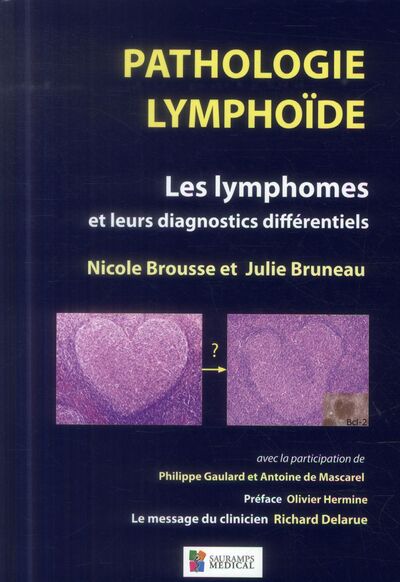Picture of PATHOLOGIE LYMPHOIDE - LES LYMPHOMES ET LEURSDIAGNOCTICS DIFFERENTIELS