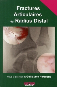 Picture of FRACTURES ARTICULAIRES DU RADIUS DISTAL