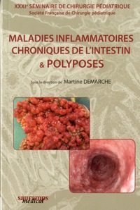 Picture of MALADIES INFLAMMATOIRES CHRONIQUES DE L'INTESTIN & POLYPOSES