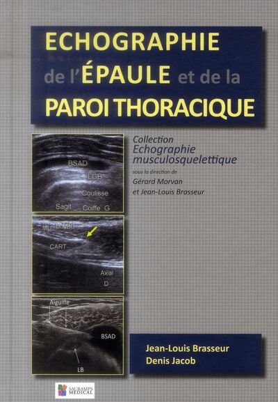 Picture of ECHOGRAPHIE DE L'EPAULE ET DE LA PAROI THORACIQUE