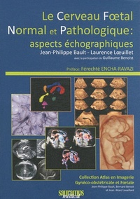 Image de LE CERVEAU FOETAL NORMAL ET PATHOLOGIQUE : ASPECTS ECHOGRAPHIQUES