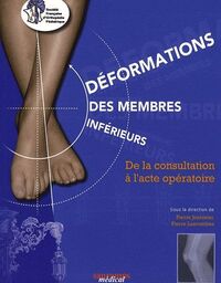 Picture of DEFORMATIONS DES MEMBRES INFERIEURS SOFOP 2009 DE LA CONSULTATION A L ACTE OPERA