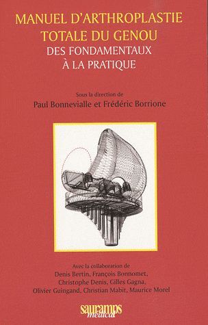 Image de MANUEL D ARTHROPLASTIE TOTALE DU GENOU DES FONDAMENTAUX A LA PRATIQUE