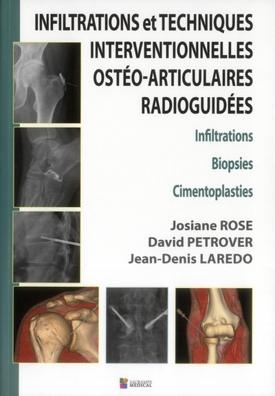 Picture of INFILTRATIONS ET TECHNIQUES INTERVENTIONNELLES OSTEO-ARTICULAIRES RADIOGUIDEES