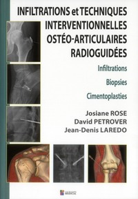 Picture of INFILTRATIONS ET TECHNIQUES INTERVENTIONNELLES OSTEO-ARTICULAIRES RADIOGUIDEES