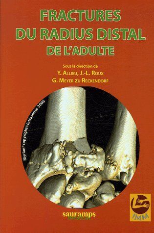 Picture of FRACTURES DU RADIUS DISTAL DE L ADULTE