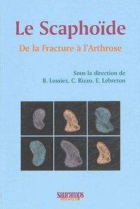 Picture of LE SCAPHOIDE