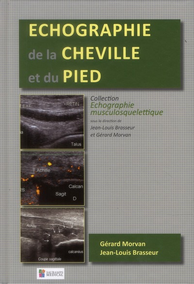 Picture of ECHOGRAPHIE DE LA CHEVILLE ET DU PIED