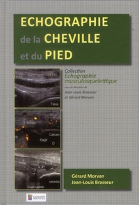 Picture of ECHOGRAPHIE DE LA CHEVILLE ET DU PIED