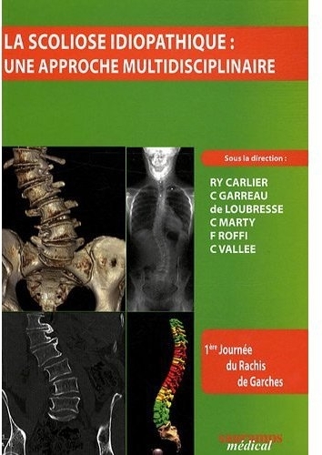 Picture of LA SCOLIOSE IDIOPATHIQUE APPROCHE MULTIDISCIPLINAIRE