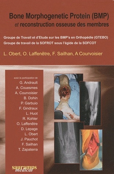 Picture of BONE MORPHOGENETIC PROTEIN BMP