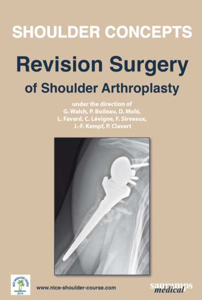 Picture of SHOULDER CONCEPTS - REVISION SURGERY OF SHOULDER ARTHROPLASTY 2014