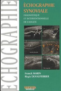 Picture of ECHOGRAPHIE SYNOVIALE DIAGNOSTIQUE ET INTERVENTIONNELLE DE L'ADULTE
