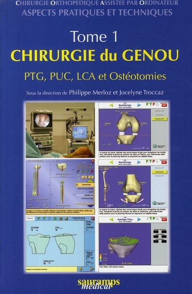 Picture of CHIRURGIE DU GENOU, TOME 1