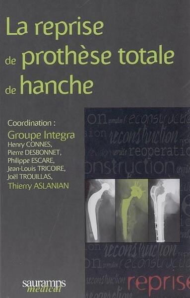 Image de LA REPRISE DE PROTHESE TOTALE DE HANCHE